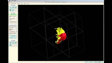 3J Construct Maxilla Posterior Region of Reference and Applying Voxel-based Registration