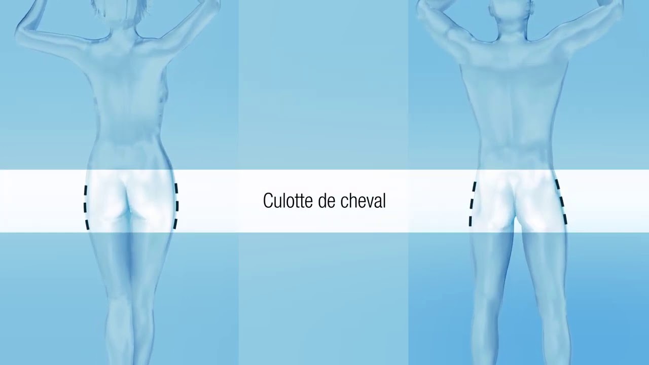 CRISTAL, la cryolipolyse médicale N°1 en France-Centre Epilation Laser&Médecine Esthétique Montlhéry