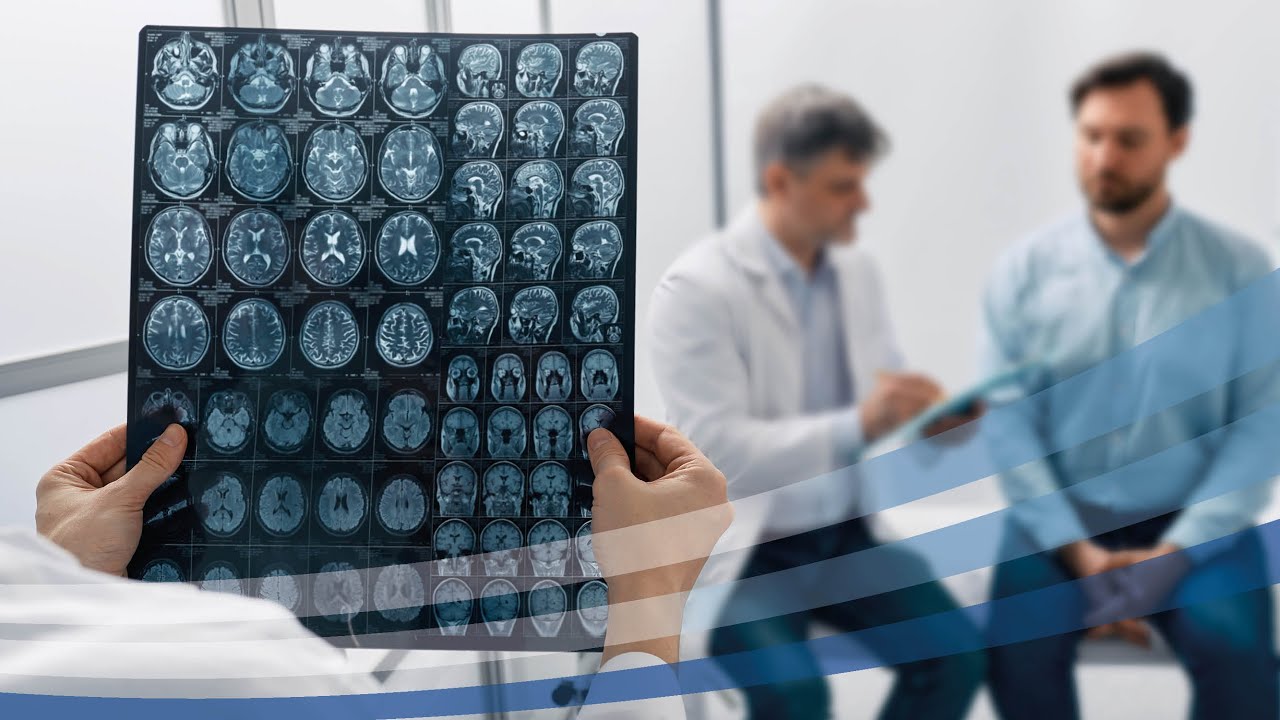 Ictus cerebrale: limitarne i danni oggi si può