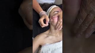 Facial cupping - have you tried this?? #medspa #skincare #skincareroutine #facial #cupping #shorts