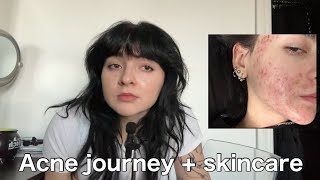yapping about my skin for 9 minutes