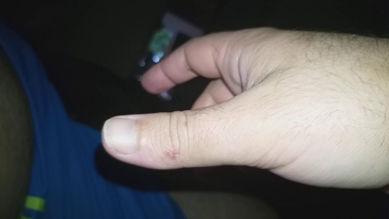 Dedo Indicador Tremendo Involuntariamente - RETOEDU