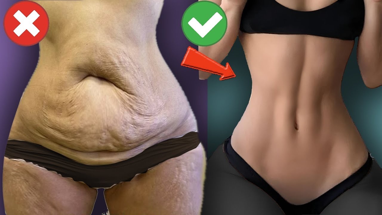 DERRETA 11kg de Gordura da Barriga RÁPIDO: Eu Faria Isso