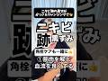 ニキビ跡の黒ずみ残ってません?ニキビが落ち着いたあとに残る黒ずみ、気になるならカッサと肌に優しいクレンジングで綺麗にましょう!