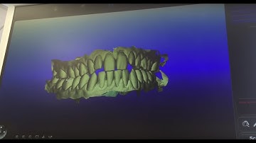 Invisalign Journey Part 2: Getting a 3D Scan of my Teeth!