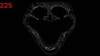 Mr Incredible Becoming Uncanny Phase 221-230