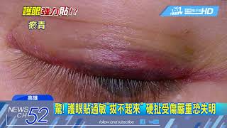 20180228中天新聞　黏性超強！　護眼貼「脫膠」　家長憂：恐連皮撕下