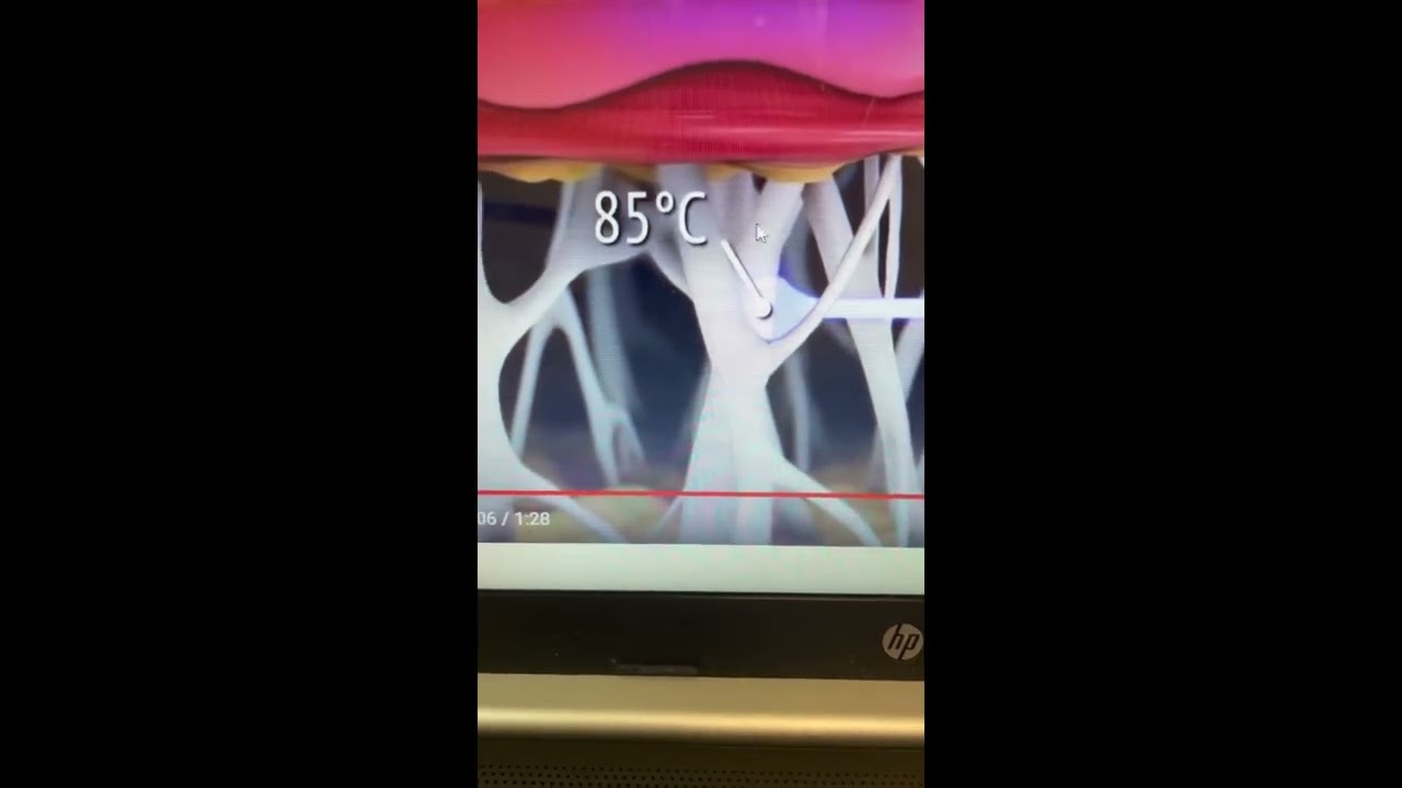 J-Plasma skin tightening explained by Dr Daniel Lee