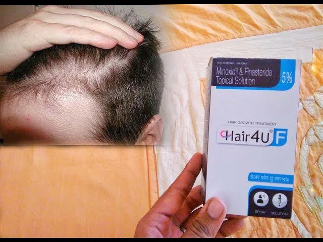 Hair 4U F 5 Hair Solution 60ml