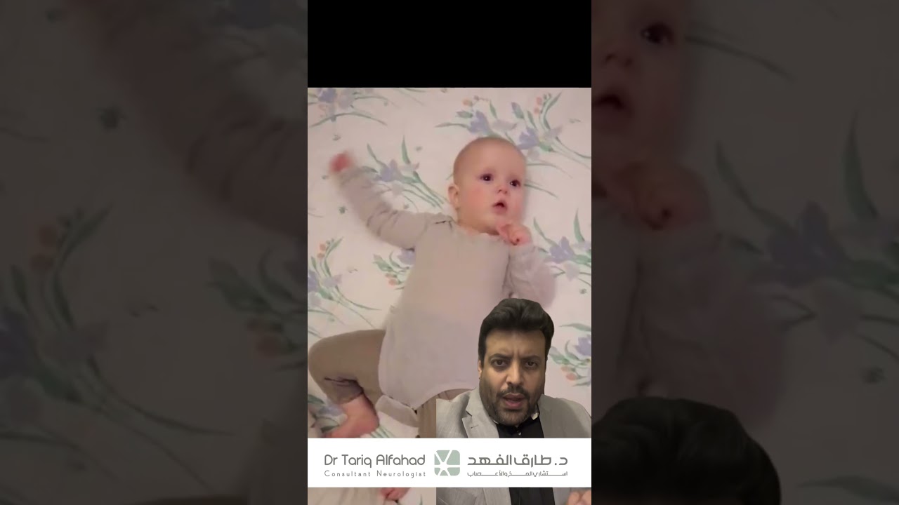 دكتور طارق الفهد و صرع على شكل تمارين عضلات البطن (متلازمة ويست)