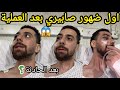 اول ضهور صابيري بعد العملية احمد صابيري بعد حادثة سير خطيرة بدراجة نارية  