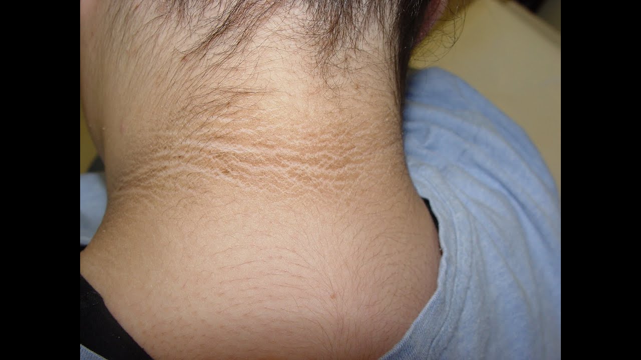 powerful presentation tips 12 Powerful Home Remedies For Dark Neck : Home Remedy to Lighten & Whiten Dark Neck