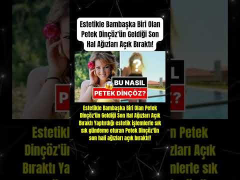 Estetikle Bambaşka Biri Olan Petek Dinçöz ün Geldiği Son Hal Ağızları Açık Bıraktı 