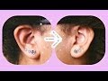 How To:Treat An Infected Ear Piercing