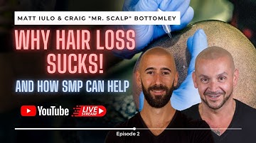 Hair loss SUCKS, How Scalp Micropigmentation can help!