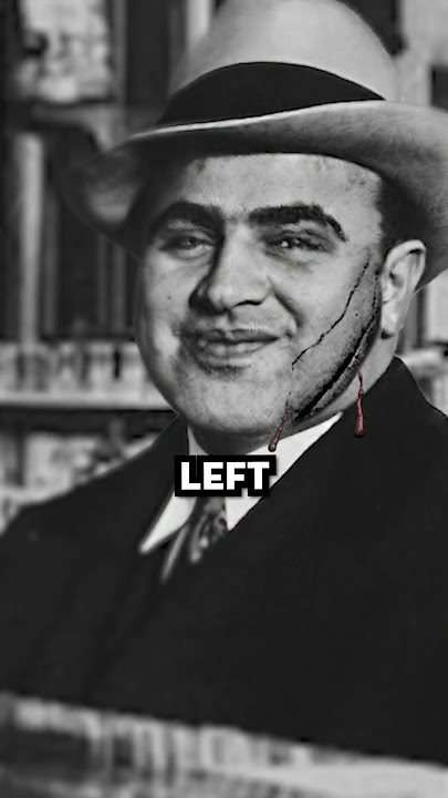 How Did Al Capone Get His Infamous Scars?