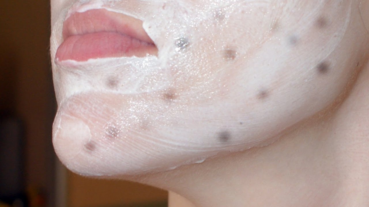 Убираем Пигментные Пятна на Лице После Прыщей?