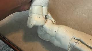 Ankle Dislocation with fracture / Big Toe Dislocation combo simulator prototype | Sports Medicine We Started Developing Ankle Dislocation Simulator Stay Tuned