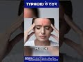 Typhoid क लक षण क य ह Typhoid Symptoms Typhoid Shorts Typhoid क लक षण क य ह Typhoid Symptoms Typhoid Shorts