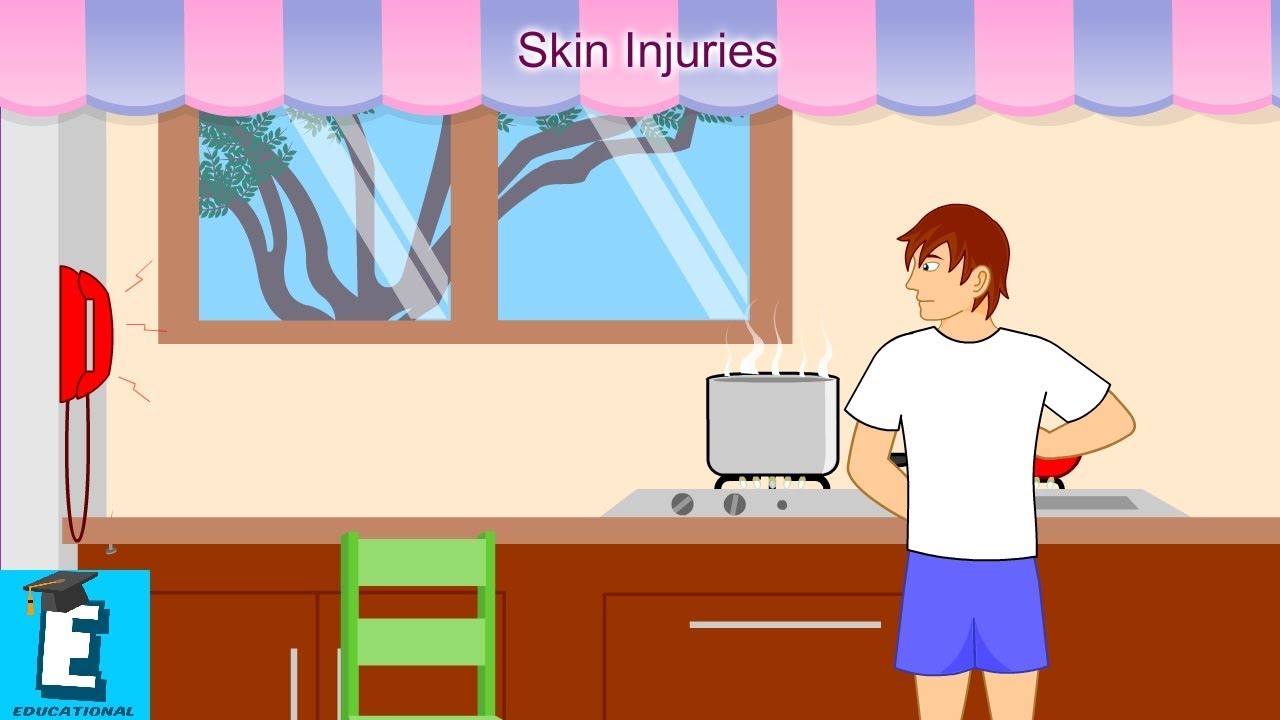 Skin Injuries Learn for Children and Kids | EDUKID Learning