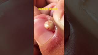 No se coman las uñas nunca más!