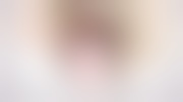 Total Laparoscopic Hysterectomy with ICG mapping of Sentinel Lymph nodes