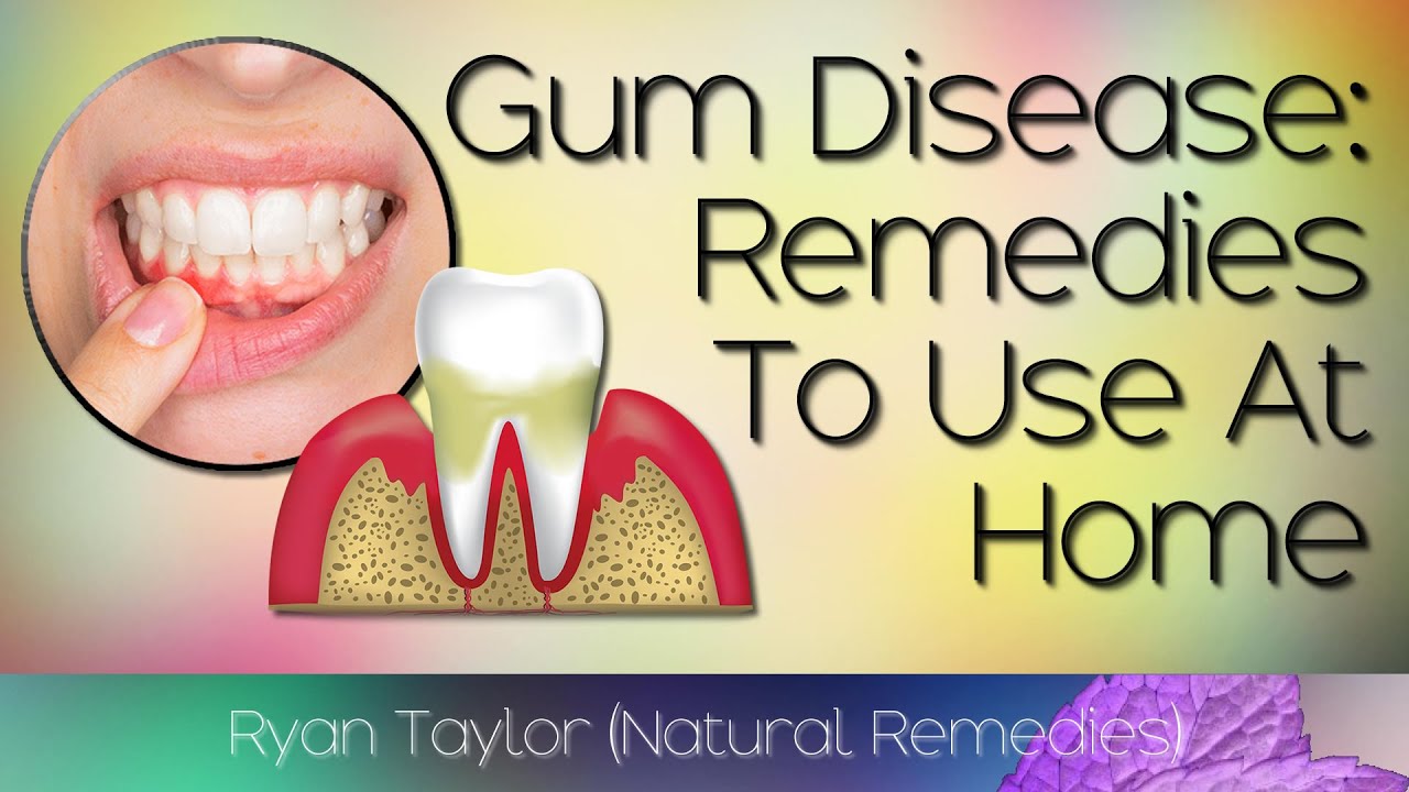 Natural Remedies: for Gum Disease (Home Treatment)