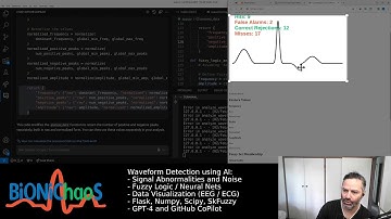 ECG Analysis with AI: Fuzzy Logic Enhancements and the Interactive ECG Game