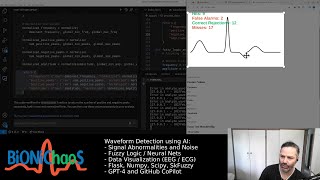 ECG Analysis with AI: Fuzzy Logic Enhancements and the Interactive ECG Game
