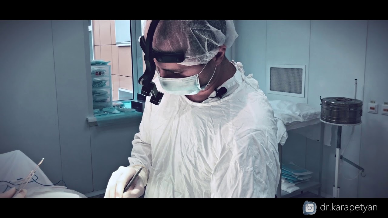 ДОКУМЕНТАЛЬНЫЙ ФИЛЬМ. РЕКОНСТРУКЦИЯ МОЛОЧНОЙ ЖЕЛЕЗЫ ПОСЛЕ МАСТЭКТОМИИ. КАДРЫ ИЗ ОПЕРАЦИОННОЙ