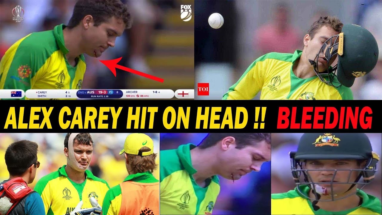 Alex Carey Hit On The Head!!  | Blood | Australia vs England | World Cup 2019