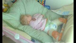 Hip Spica-Baby-Toddler-Sleeping.mp4 - YouTube