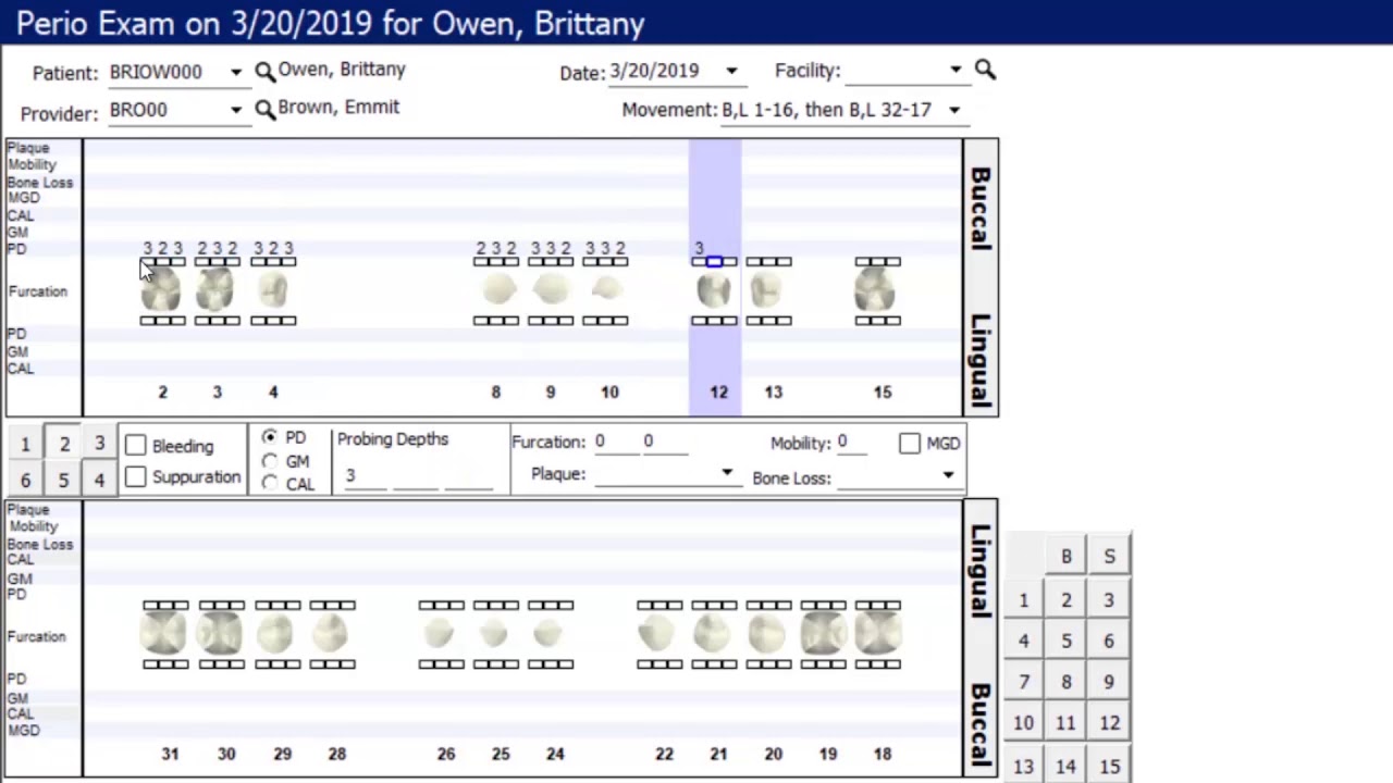 Perio Charting Dental