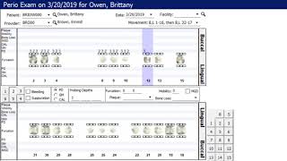 Perio Charting | Dental Software Tip