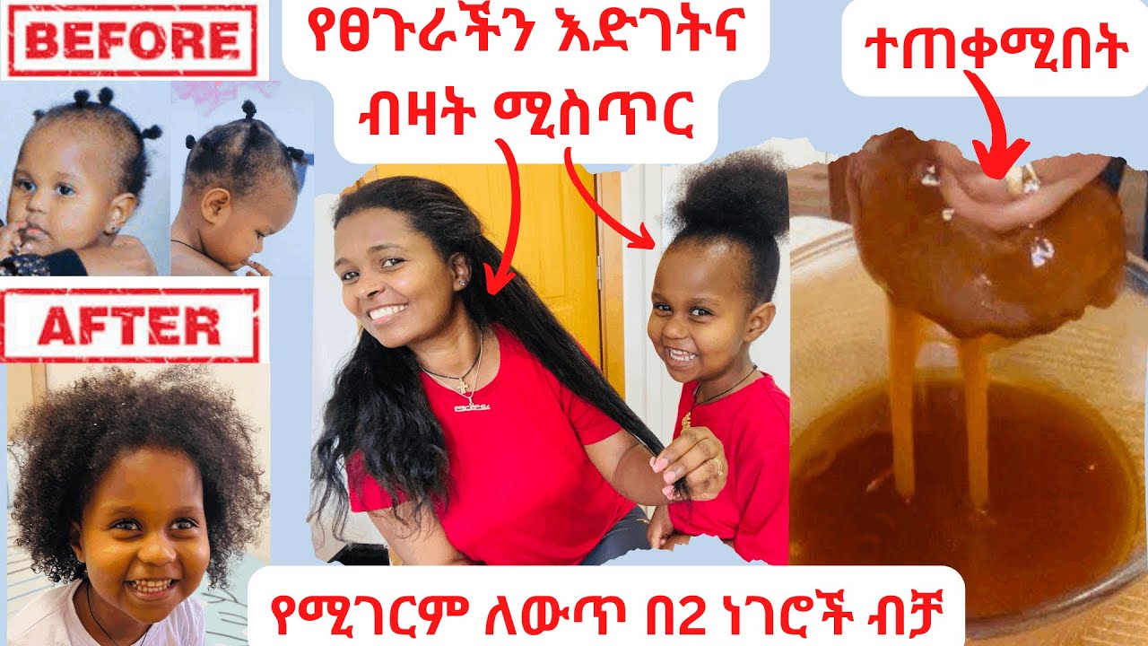 ተአምረኛው የፀጉር ማሳደጊያ ውህድ በ2 ነገሮች ብቻ ለፀጉር እድገትና ልስላሴ