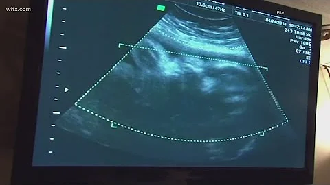 SC lawmakers set to debate more restrictive abortion ban