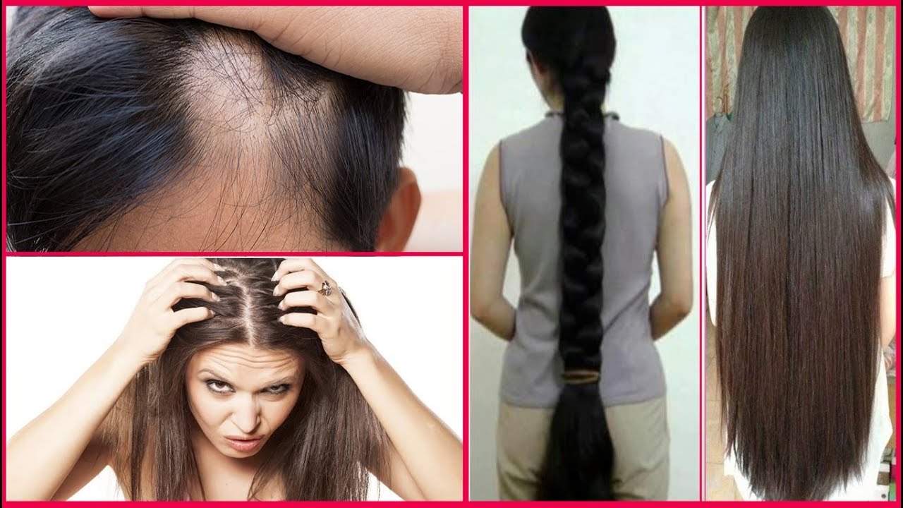 Kis Vitamin Ki Kami Se Hair Fall Hota Hai andre