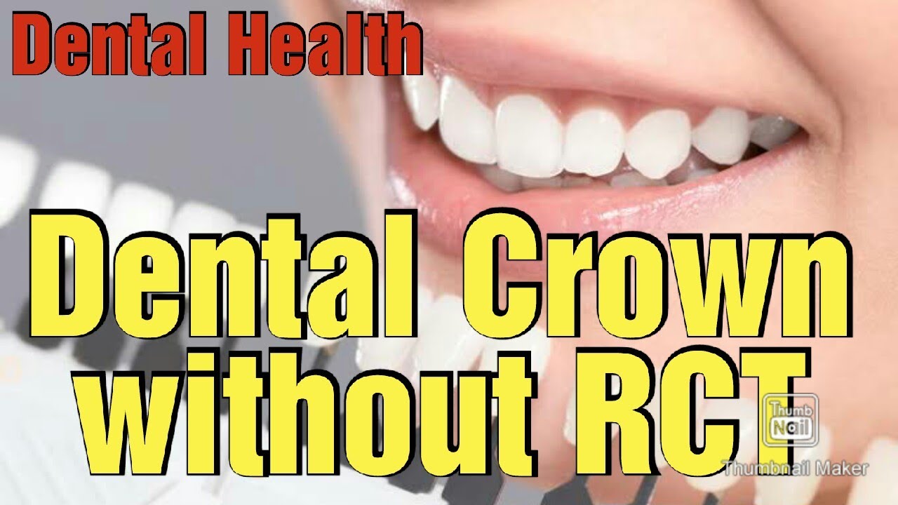 Dental crown without RCT Dental Clinic