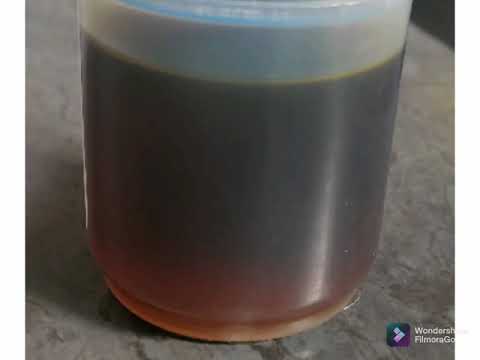 How Does Coke Coloured Urine Actually Looks Like