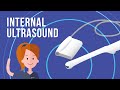 Having a Transvaginal Ultrasound with Queensland X-Ray