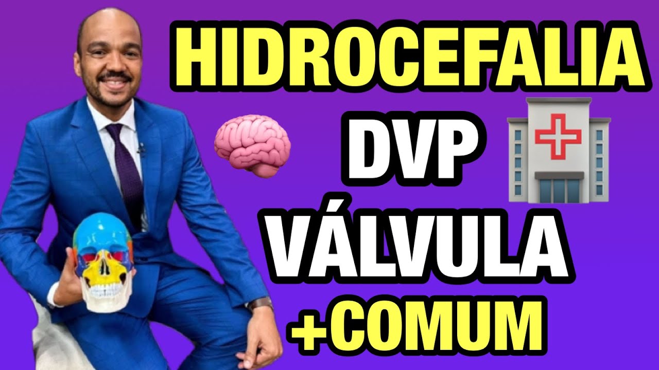 Entenda os sistemas de derivação ventrículo peritoneal: HIDROCEFALIA E VÁLVULAS