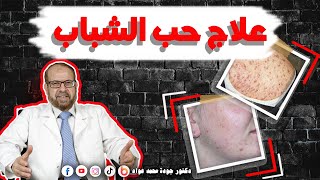 علاج حب الشباب - نتائج مذهلة