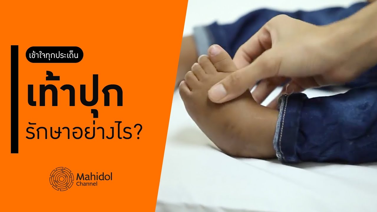 เท้าปุก คืออะไร? รักษาอย่างไร? [หาหมอ by Mahidol Channel]