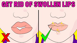 How to Fix Swollen Lips Naturally