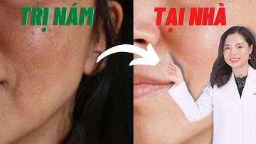 Nám da mặt và cách chữa trị nám da mặt tại nhà bằng 3 bước đơn giản - Bác sĩ Nguyên