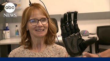 Groundbreaking prosthetics that feel touch