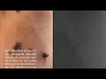 Beginning of video