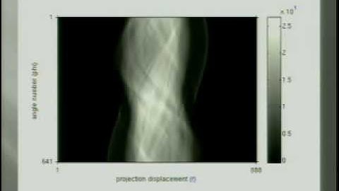 CT Image Reconstruction