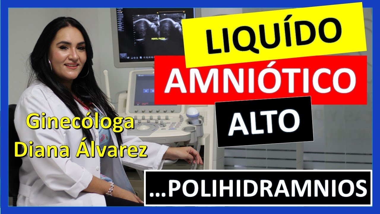 ¡¡¡TENGO MUCHO LIQUIDO AMNIÓTICO!!!, POLIHIDRAMNIOS, por GINECOLOGA DIANA ALVAREZ