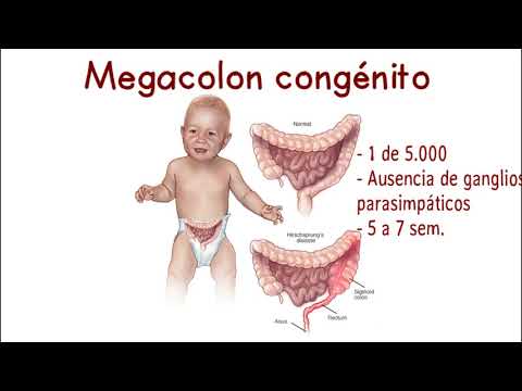 Video: Le Variazioni Del Numero Di Copie Nelle Regioni Genomiche Candidate Confermano L'eterogeneità Genetica E La Parzialità Dei Genitori Nella Malattia Di Hirschsprung